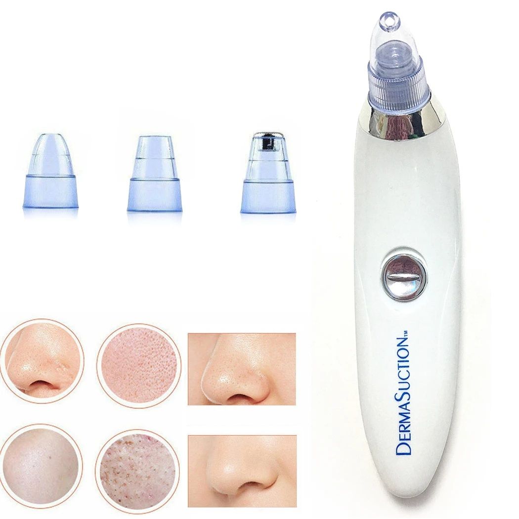 Bye Bye Blackheads! Cell-Powered Derma Suction Blackhead Remover (4-in-1)